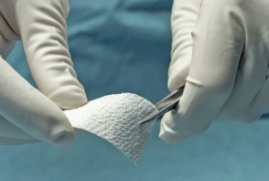 Fischhaut, chronische Wundbehandlung, Wundzentrum Kassel / Nordhessen