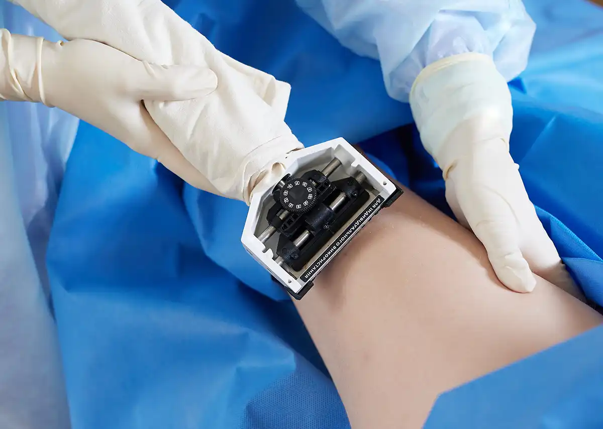 Skin Grafting, Cassel Wound Center, Kassel - Germany